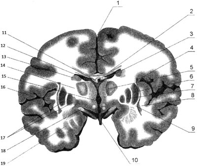 Фронтальный разрез полушарий головного мозга