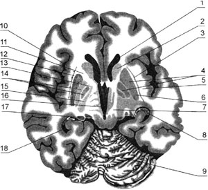 Горизонтальный срез головного мозга на уровне базальных ядер