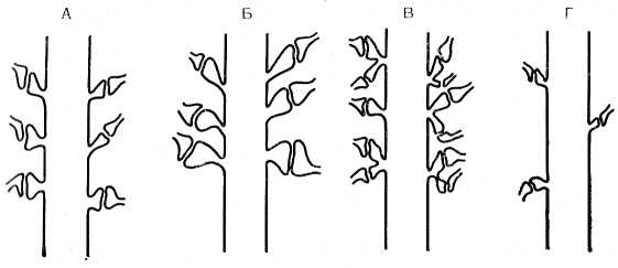 Рис. 8. Схема, иллюстрирующая реакцию ША при формировании эн- грамм памяти (Eccles, 1973). А - норма шипиков; Б — гипертрофия шипиков; В — деление шипиков; Г — утрата функции шипиков.